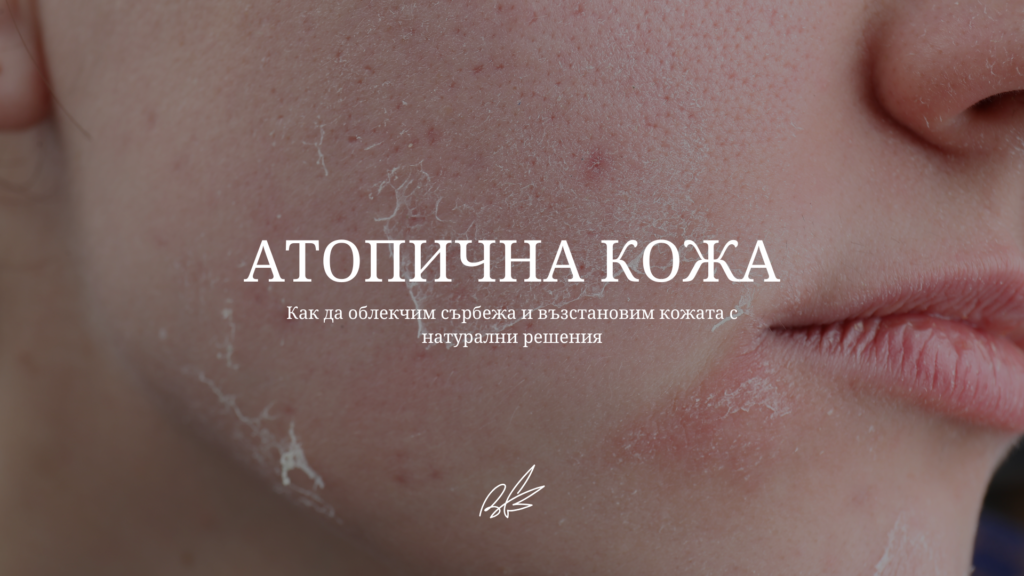 showing the main theme of the blog post - atopic sking and how to get over with it. атопична кожа